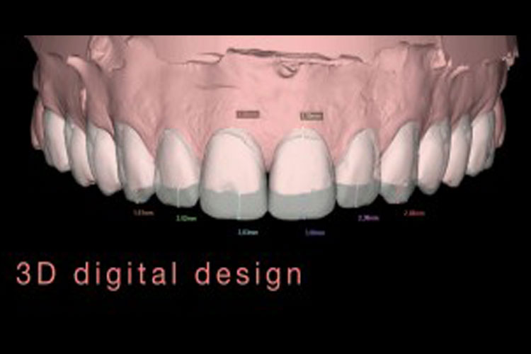 3D Digital Design Services